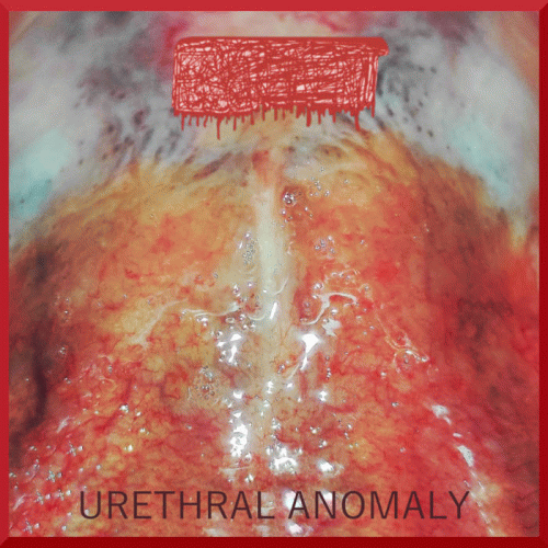 Escrement : Urethral Anomaly